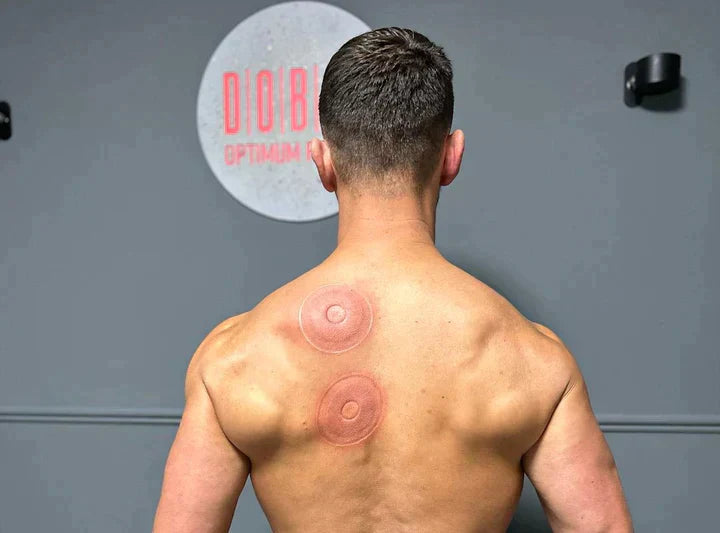 SmartCup electric cupping therapy before and after muscle relief results