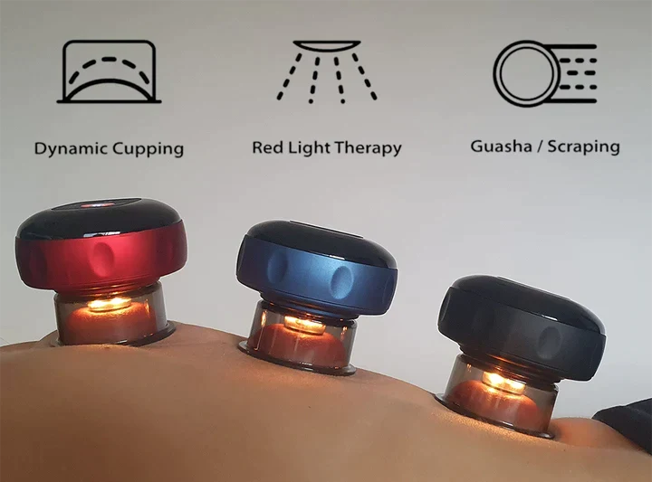 SmartCup cupping therapy device in use on back muscles