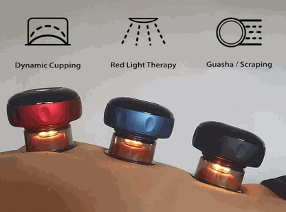 SmartCup — Smart Electric cupping therapy device in red, blue and black, with translucent suction cups and glowing light rings
